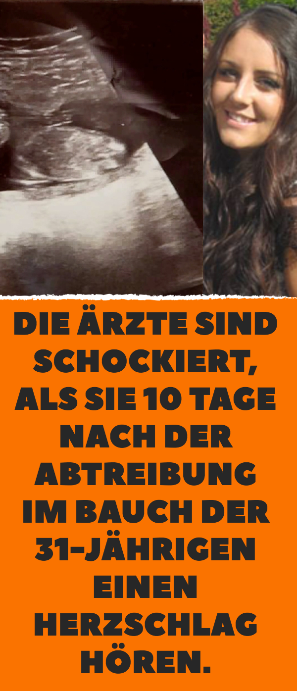 Die Ärzte sind schockiert, als sie 10 Tage nach der Abtreibung im Bauch der 31-Jährigen einen Herzschlag hören.