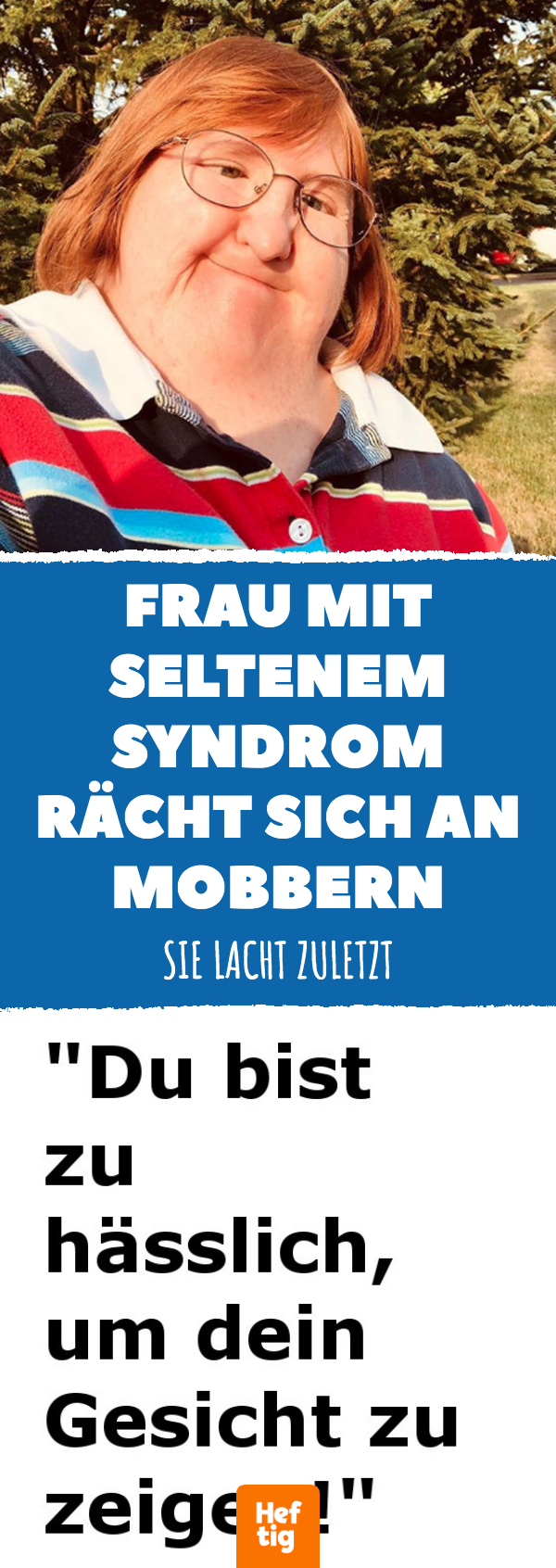 40-Jährige mit seltenem Syndrom rächt sich an Mobbern