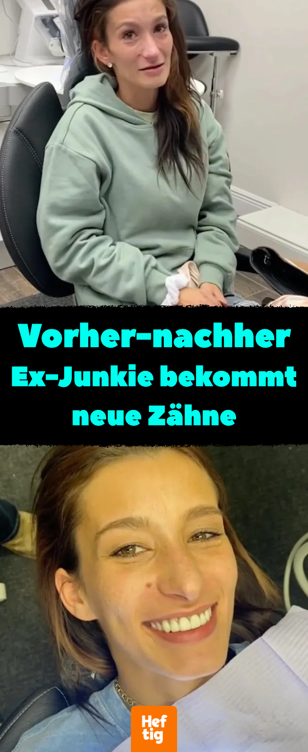 Zahnloser Ex-Junkie nach Zahn-OP nicht wiederzuerkennen