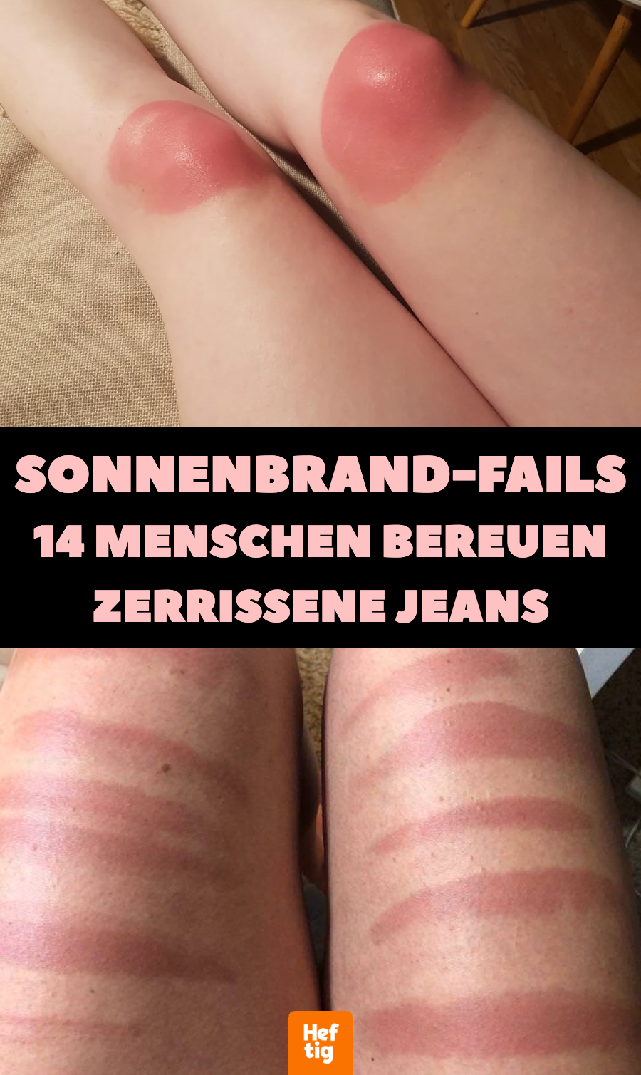 14 Sonnenbrand-Überraschungen nach dem Hose-Ausziehen