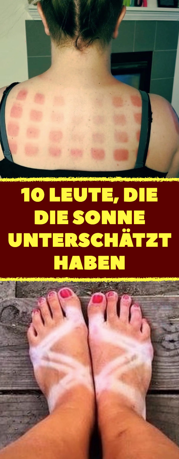 10 Leute, die die Sonne unterschätzt haben